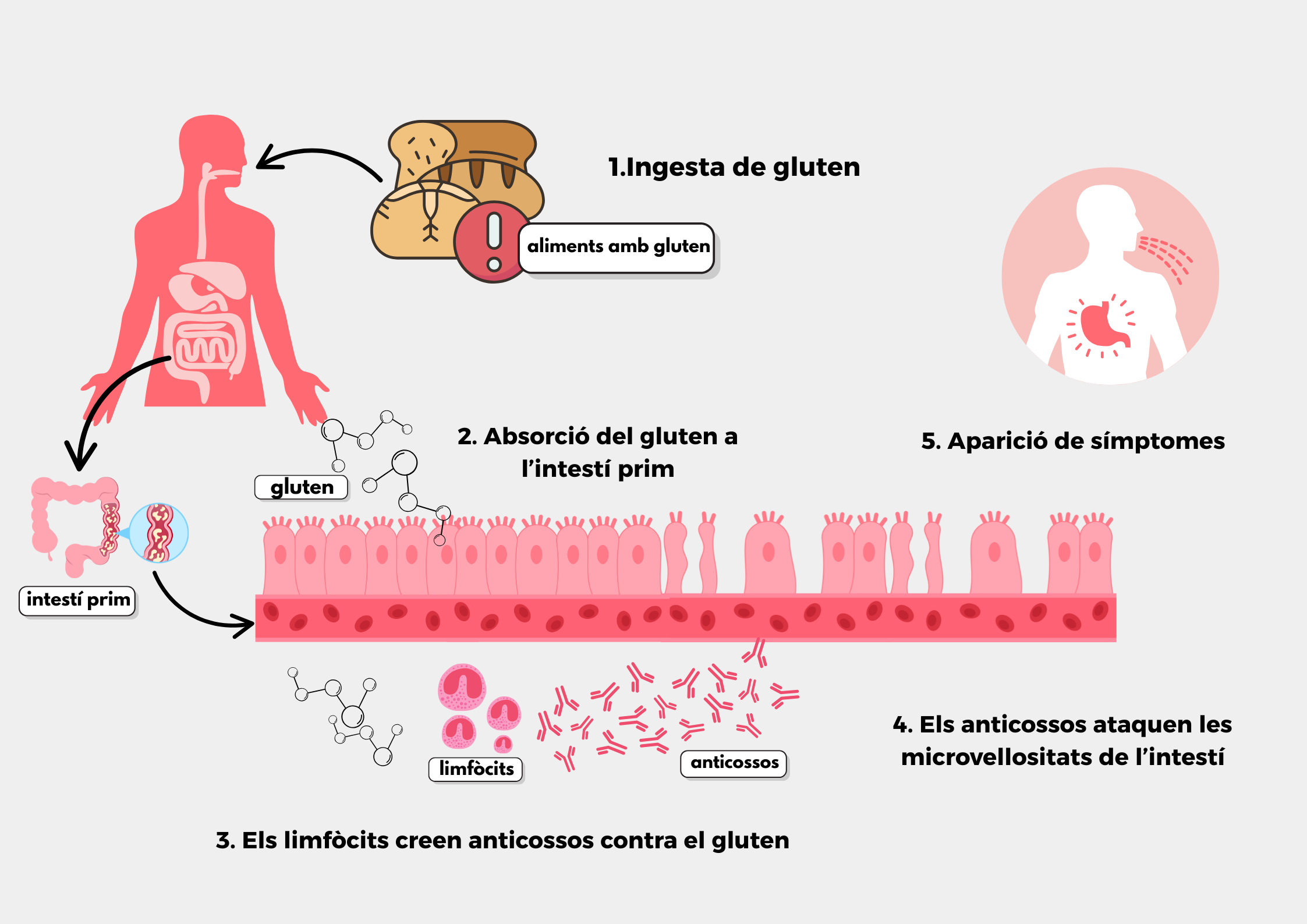 Infografía celiaquia (1)